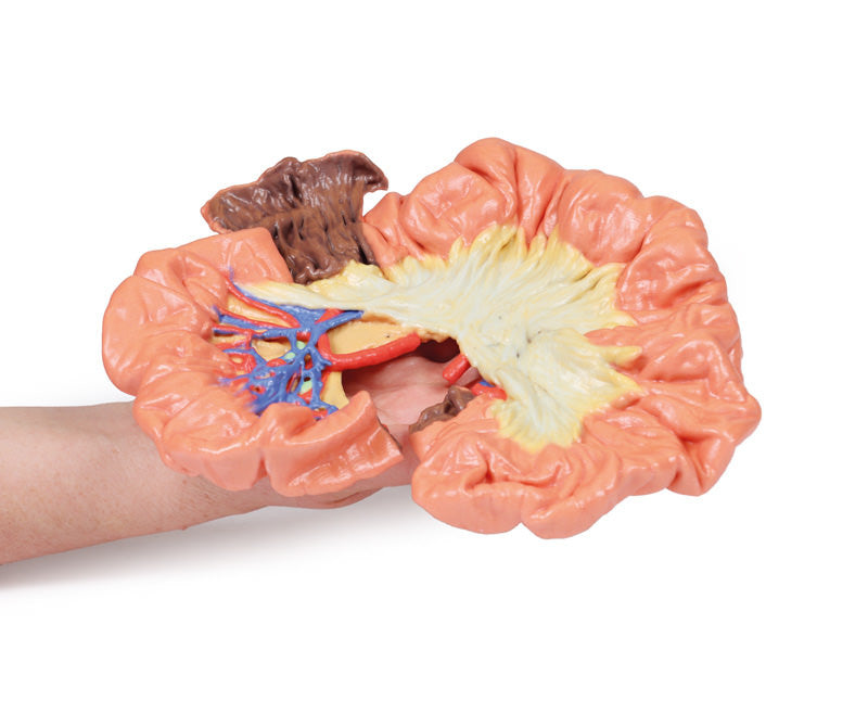 Bowel - Portion of Ileum - 3D Printed Cadaver