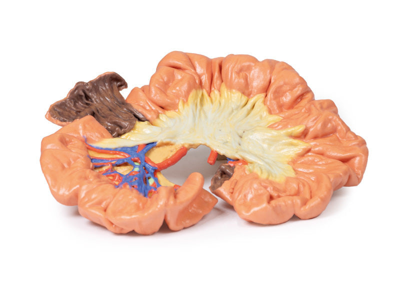 Bowel - Portion of Ileum - 3D Printed Cadaver