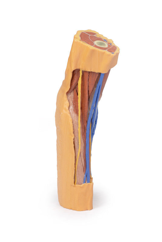 Cubital Fossa - 3D Printed Cadaver