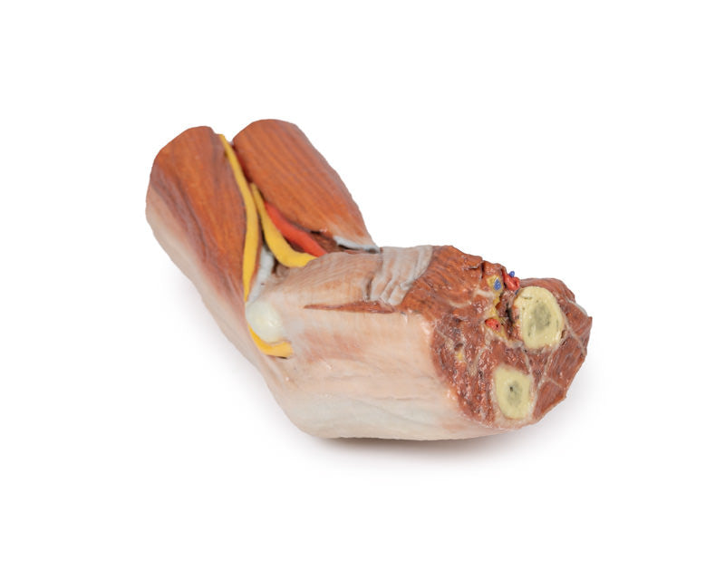 Cubital fossa - muscles, large nerves and the brachial artery - 3D Printed Cadaver