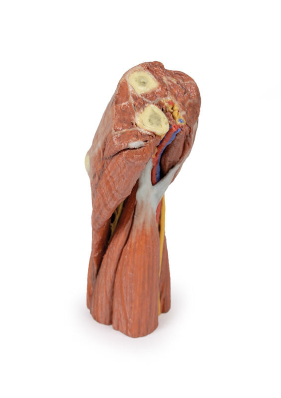 Cubital fossa - muscles, large nerves and the brachial artery - 3D Printed Cadaver