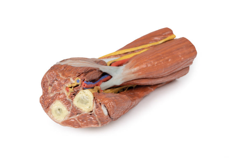 Cubital fossa - muscles, large nerves and the brachial artery - 3D Printed Cadaver