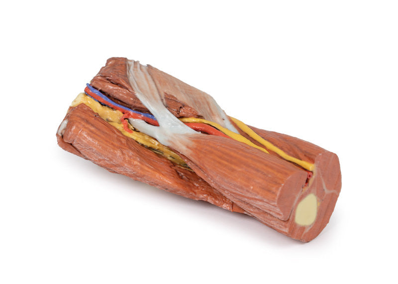 Cubital fossa - muscles, large nerves and the brachial artery - 3D Printed Cadaver