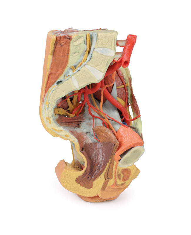 Female left pelvis and proximal thigh - 3D Printed Cadaver