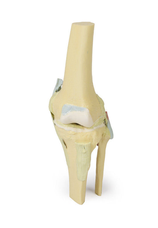 Knee Joint - 3D Printed Cadaver