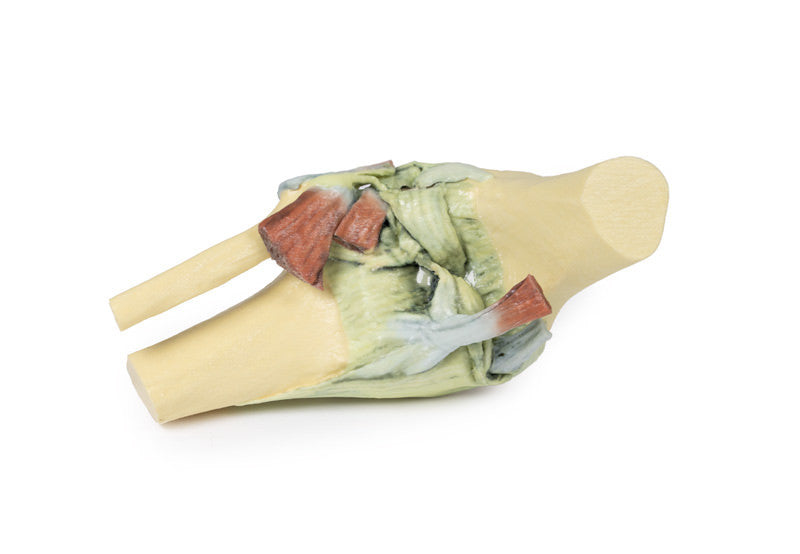 Knee Joint - 3D Printed Cadaver