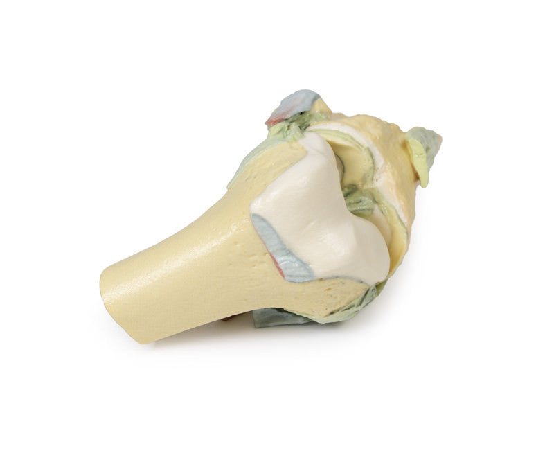 Knee Joint - 3D Printed Cadaver