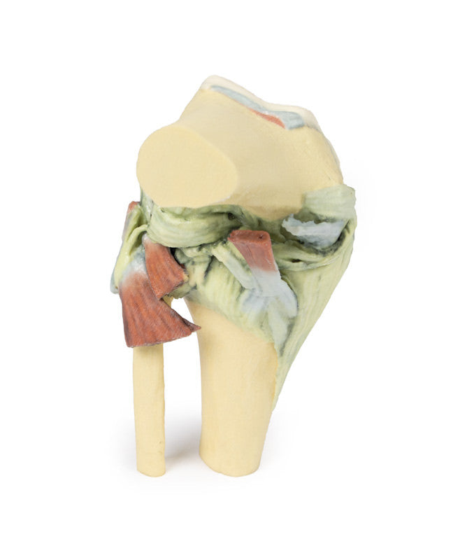 Knee Joint - 3D Printed Cadaver