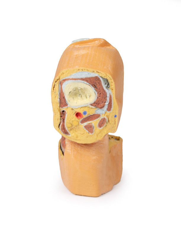 Flexed knee joint deep dissection - 3D Printed Cadaver