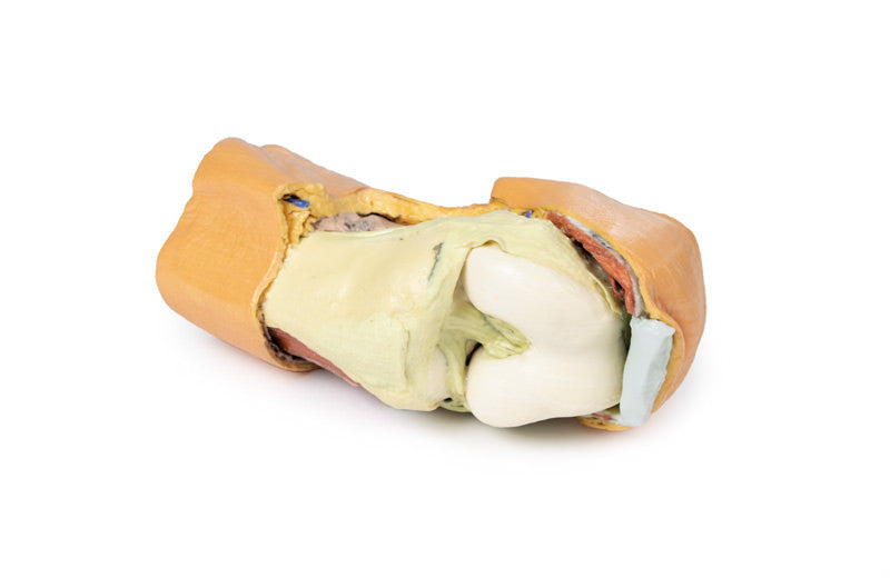 Flexed knee joint deep dissection - 3D Printed Cadaver