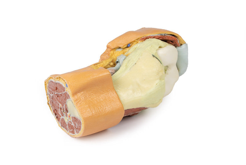 Flexed knee joint deep dissection - 3D Printed Cadaver
