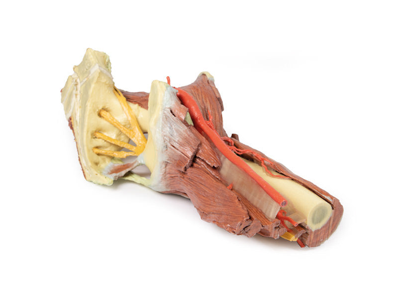 Lower Limb - deep dissection of a left pelvis and thigh - 3D Printed Cadaver