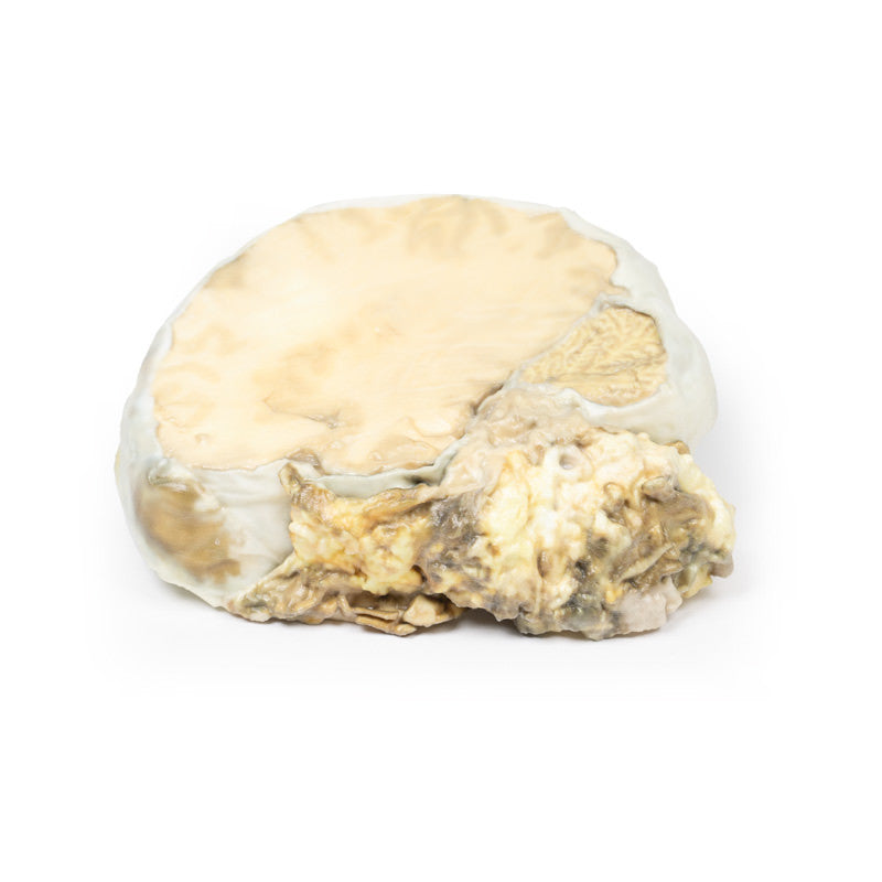 Pituitary Adenoma