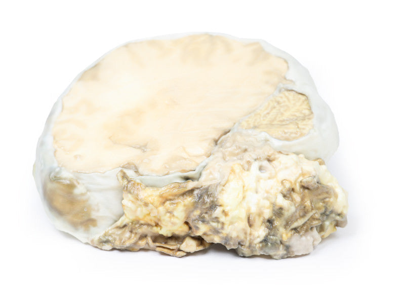 Pituitary Adenoma