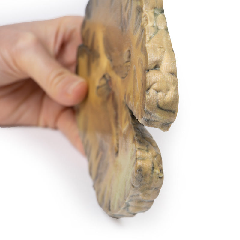 Ventriculitis, Secondary to Septicaemia