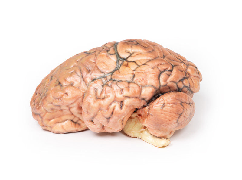 Craniopharyngioma