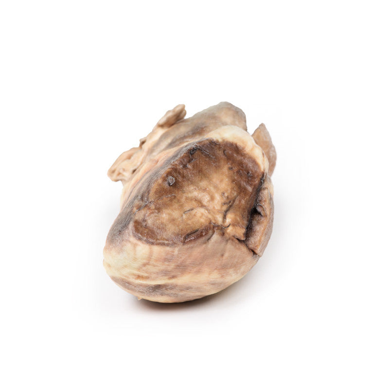 Congenital Pulmonary Stenosis