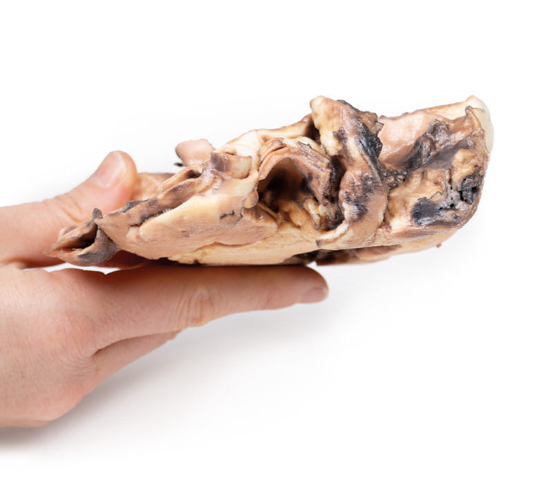 Rheumatic endocarditis
