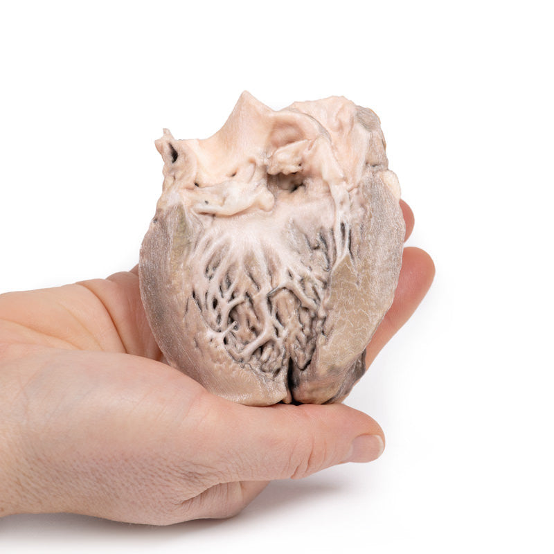Acute Bacterial Endocarditis
