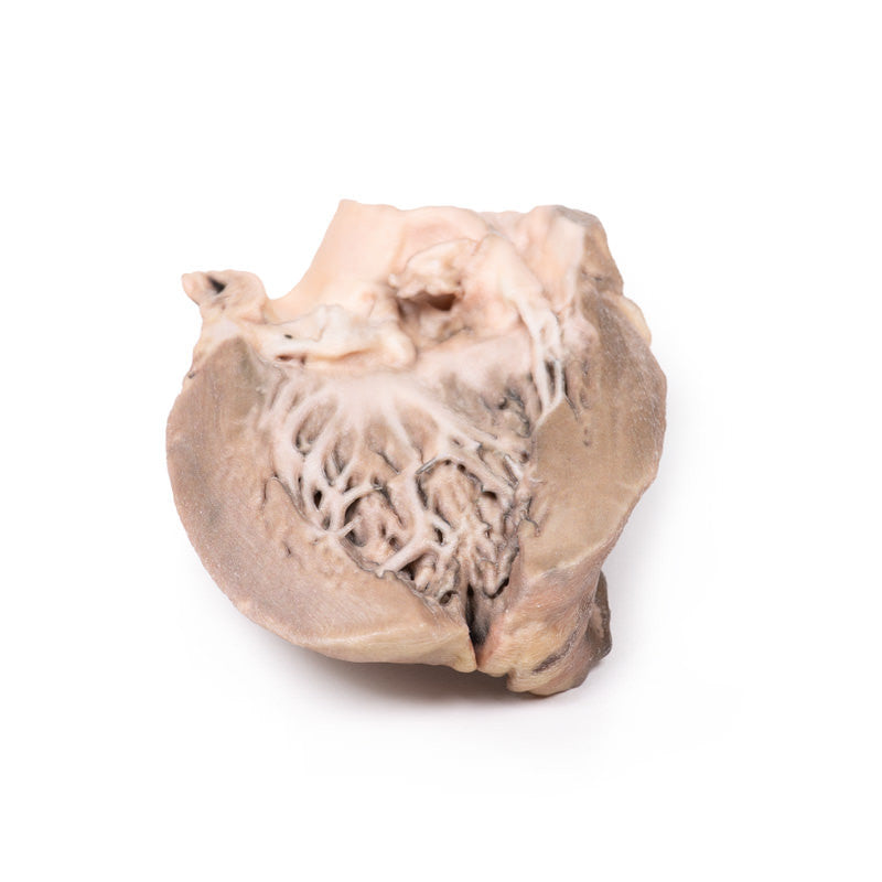 Acute Bacterial Endocarditis