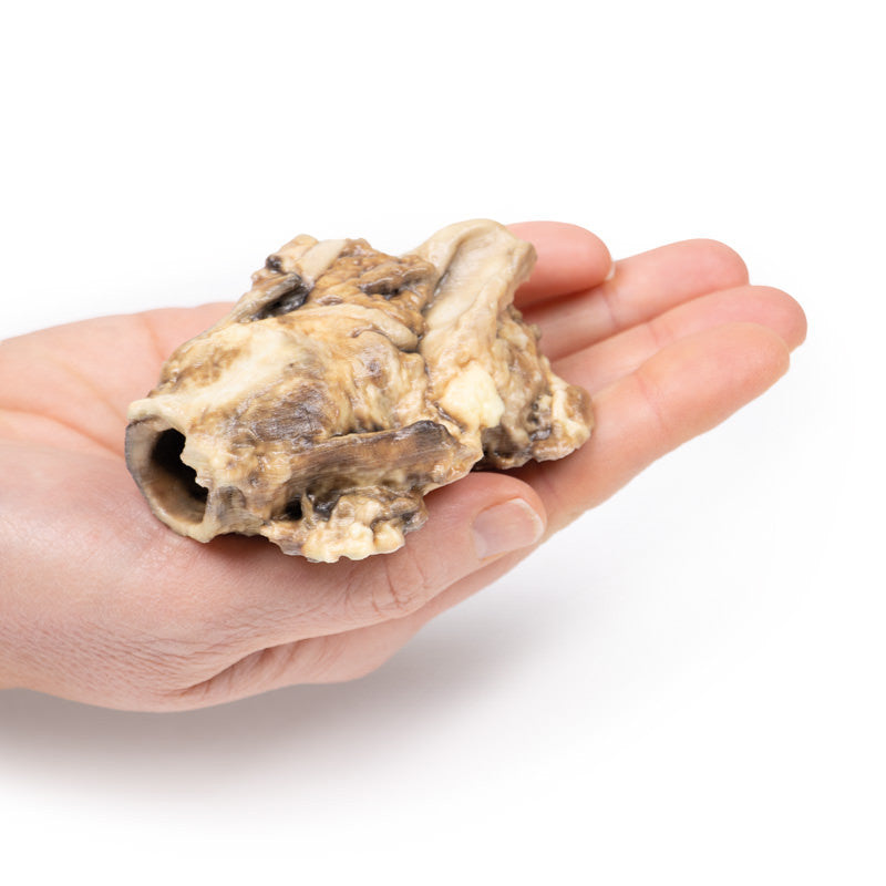 Carcinoma of Pyriform Fossa