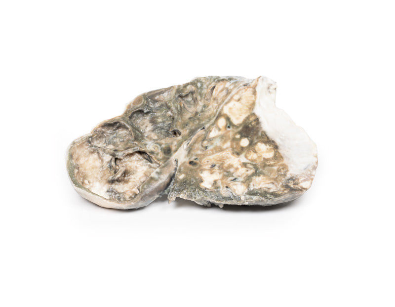 Fibrocaseous Tuberculosis