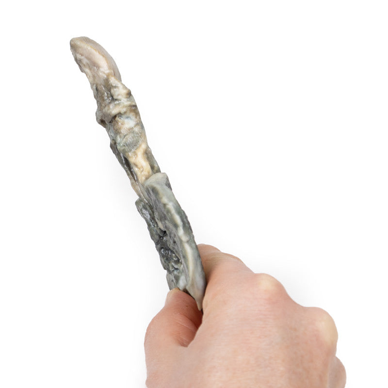 Tracheoesophageal Fistula and Oesophagus Atresia