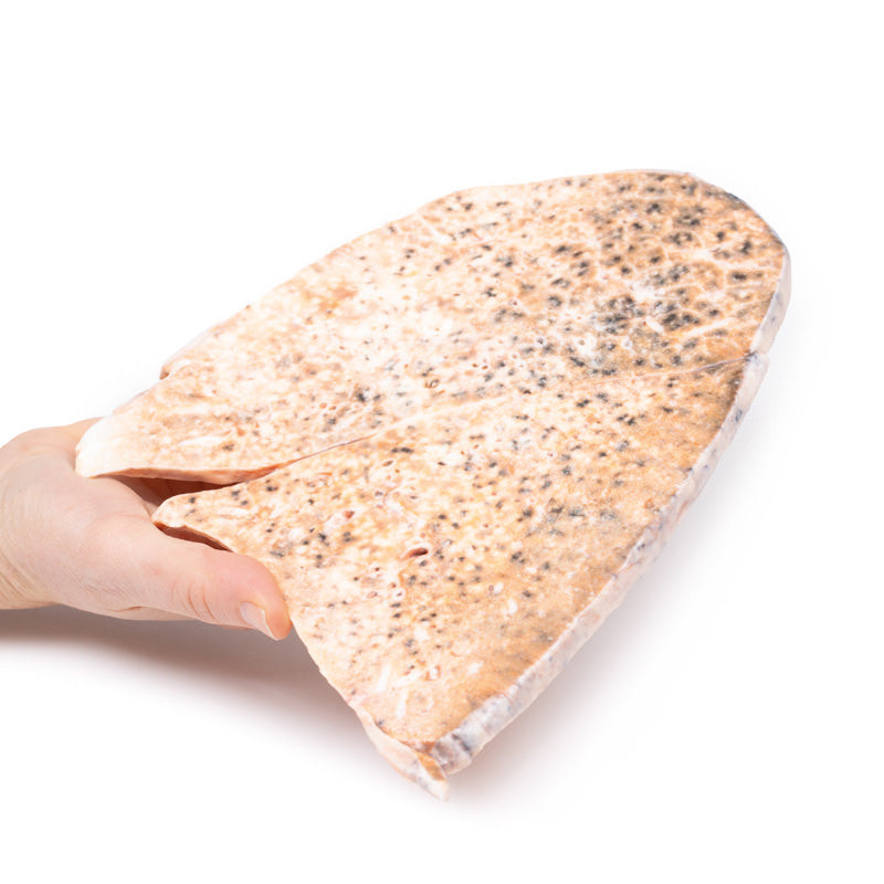 Right lung miliary tuberculosis