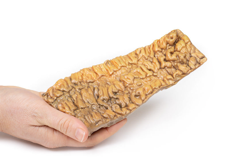 Ulcerative Colitis
