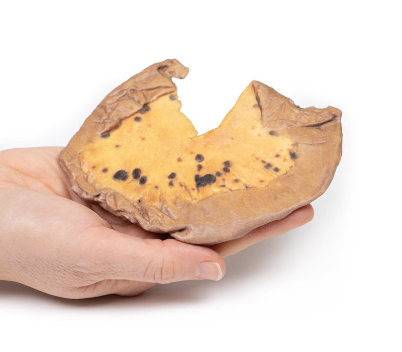 Mesenteric Metastases from Cutaneous Malignant Melanoma