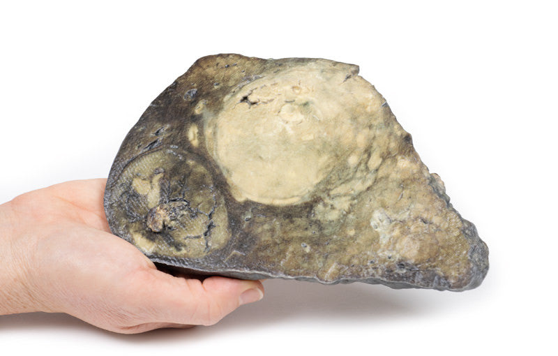 Hepatocellular Carcinoma