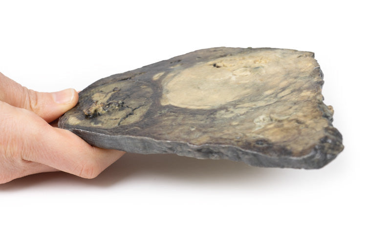 Hepatocellular Carcinoma
