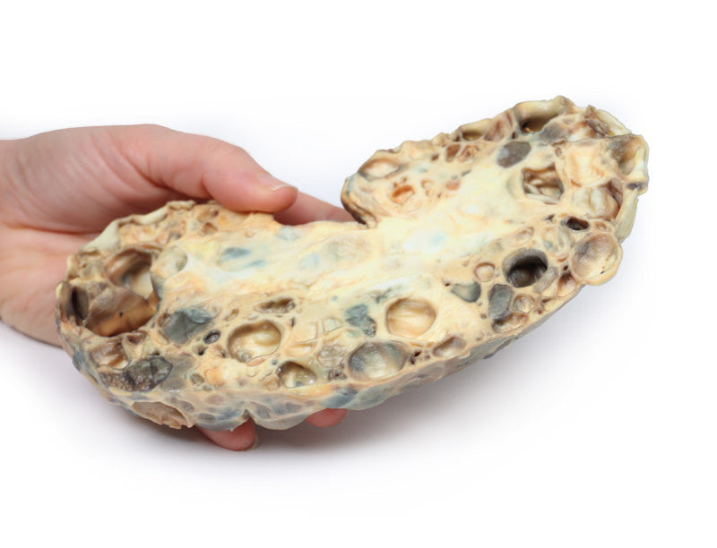 Adult polycystic kidney disease