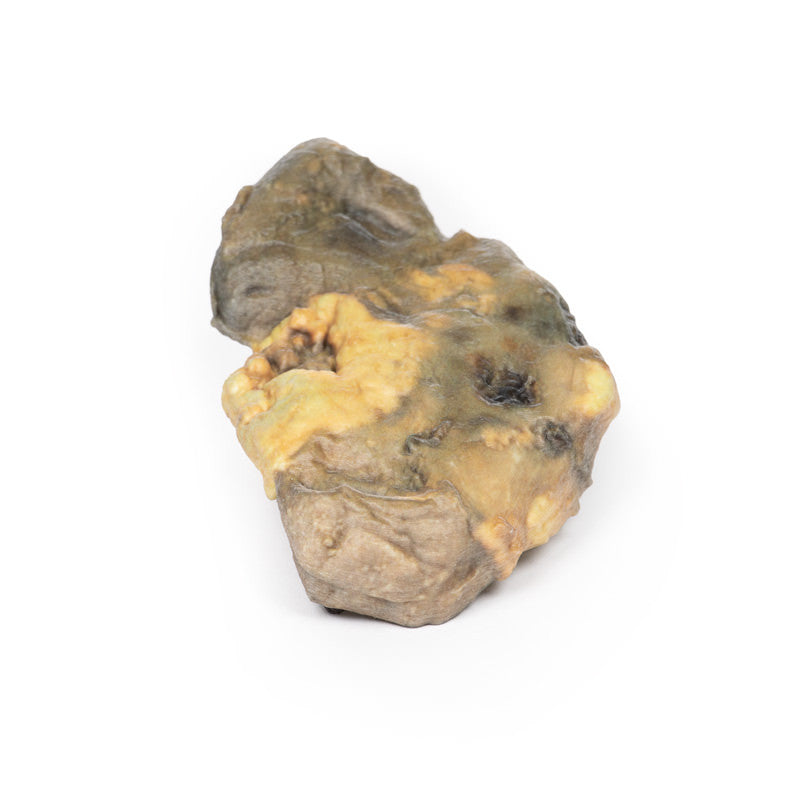 Pyonephrosis