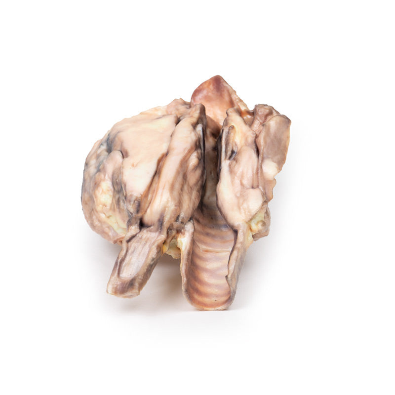 Lymphoma of the thyroid