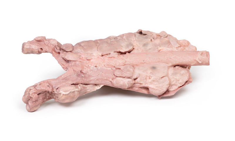 Aorta & para-aortic lymph nodes