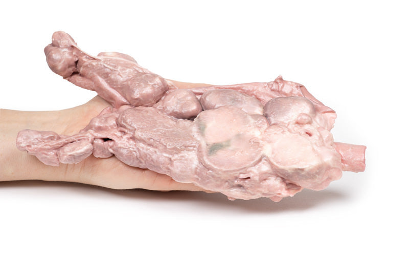 Aorta & para-aortic lymph nodes