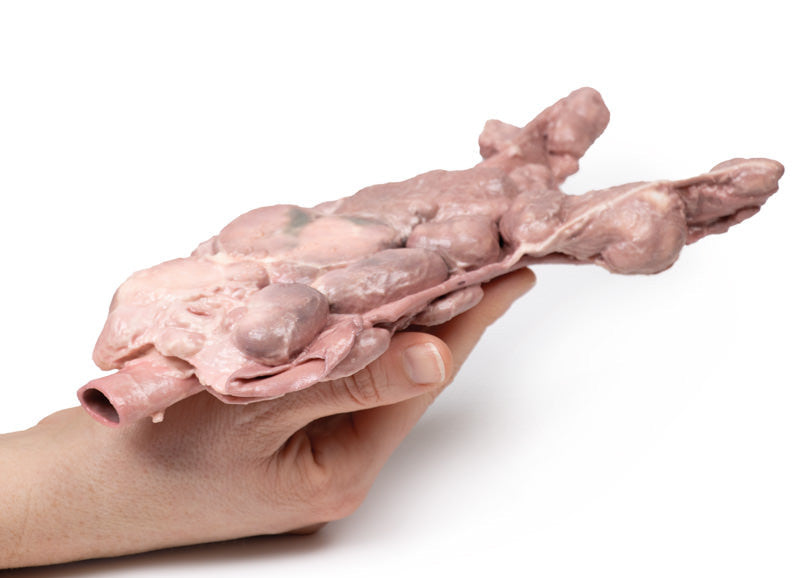 Aorta & para-aortic lymph nodes
