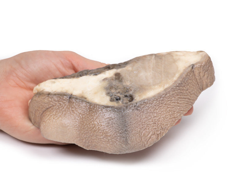 Carcinoma of Breast