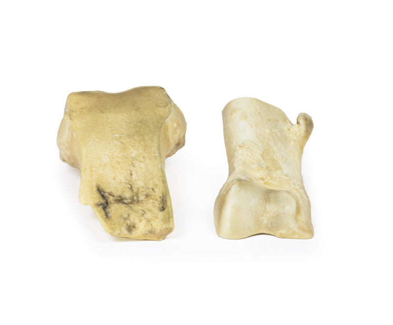 Osteochondroma