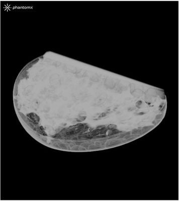 Breast Phantom for Mammography and Breast Tomosynthesis