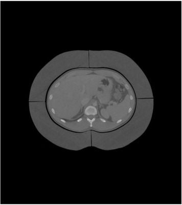 5 cm fat ring for abdomen phantom
