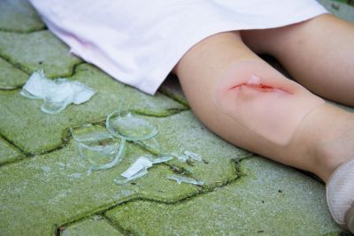 Wound moulage "cut with glass fragment"