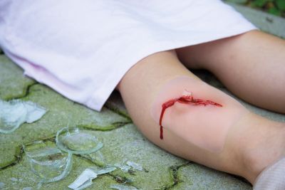 Wound moulage "cut with glass fragment"