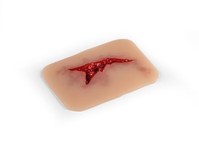 Wound moulage "laceration"