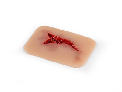 Wound moulage "laceration"