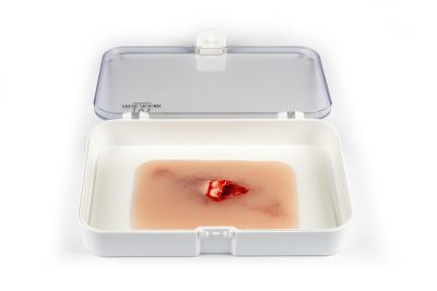 Wound moulage "open fracture"