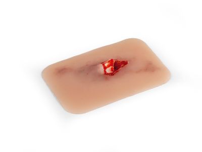 Wound moulage "open fracture"