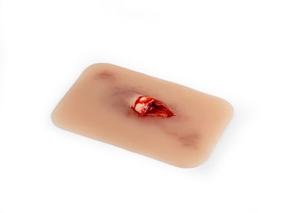 Wound moulage "open fracture"