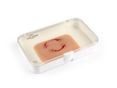 Wound moulage "human bite"